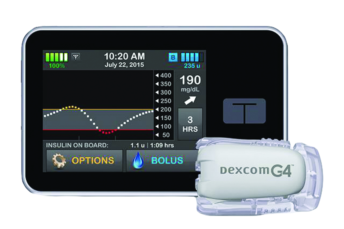 Insulin Pump Comparison Chart 2019