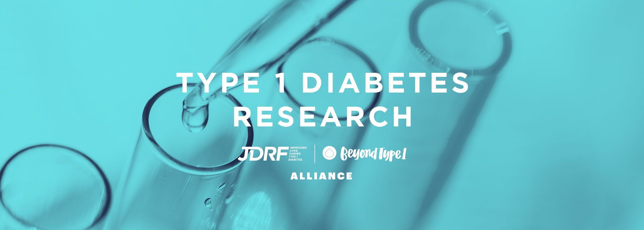 research diabetes type 1