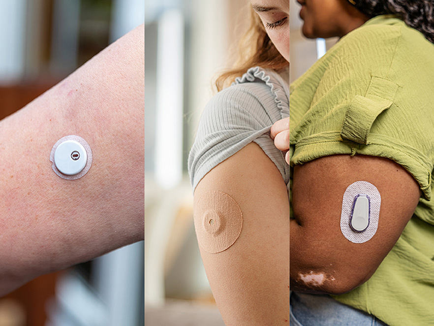 A few images of CGMs on arms.