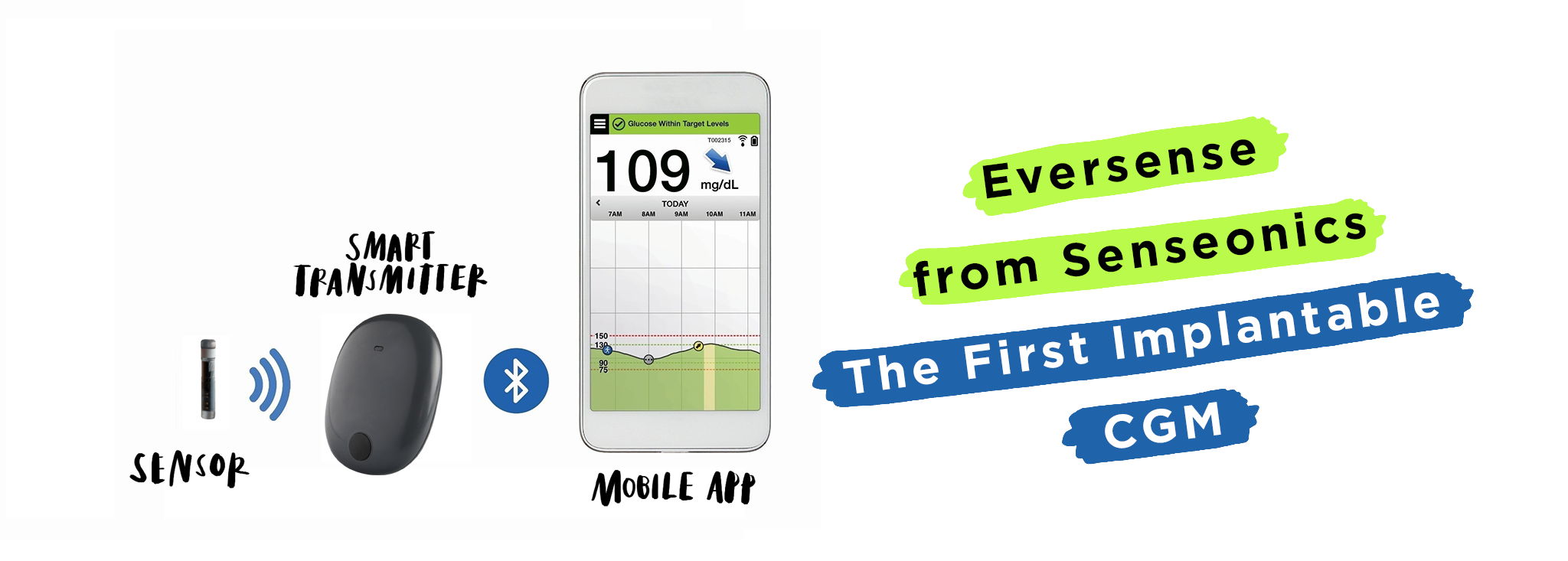 Eversense from Senseonics: The First Implantable CGM