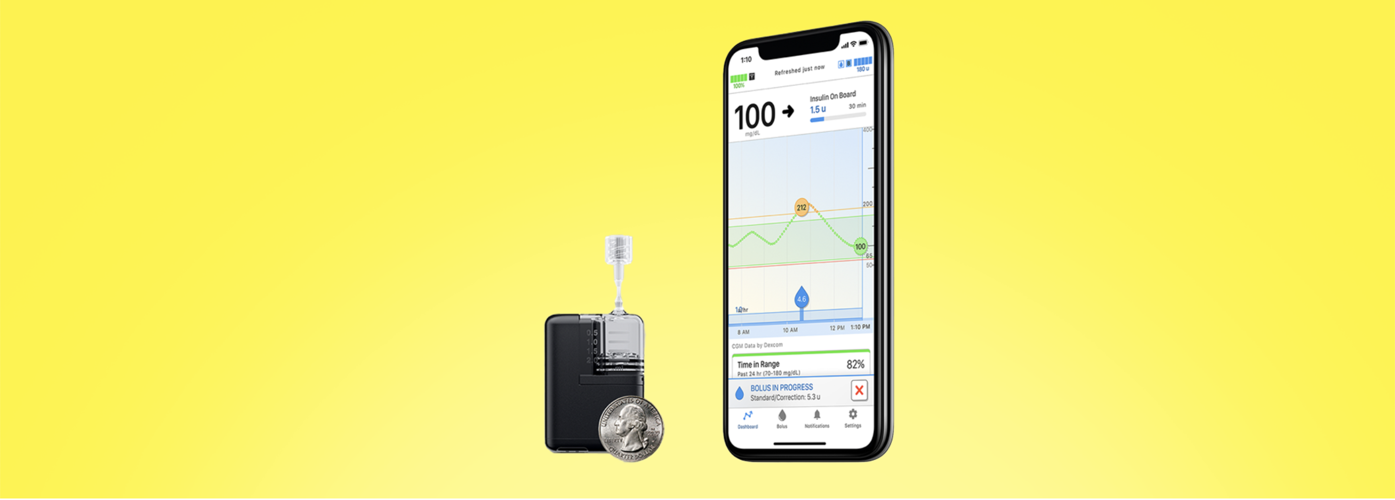 Tandem Mobi Pump and the Dexcom G7 CGM Are Now Connected