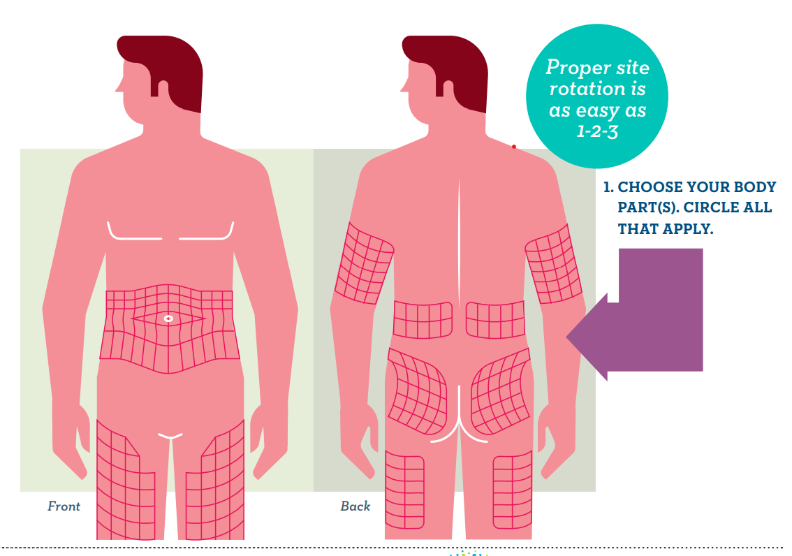 Does It Matter Where You Inject Insulin