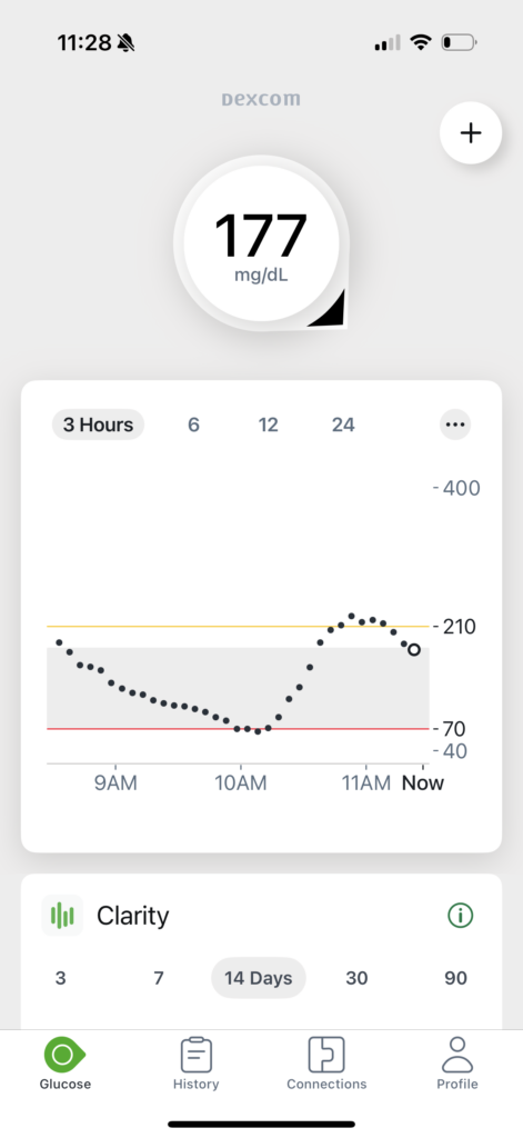 Ariel's Dexcom app reading.